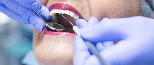 Best Emergency Treatment for Oral Infections in Jonesboro, GA